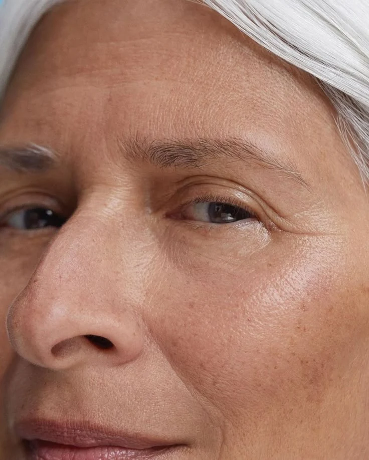 Relleno de ojeras